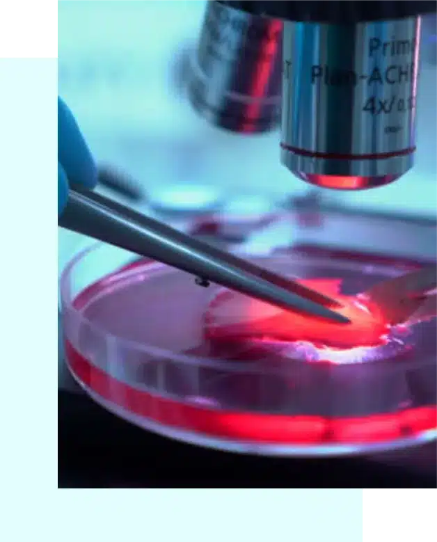 stem cell treatment in Cancun