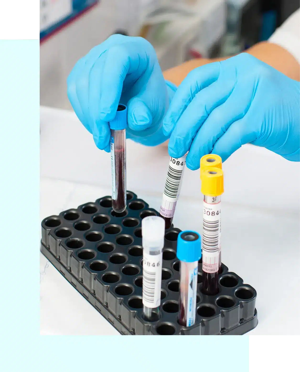 stem cells in Puerto Vallarta, Mexico